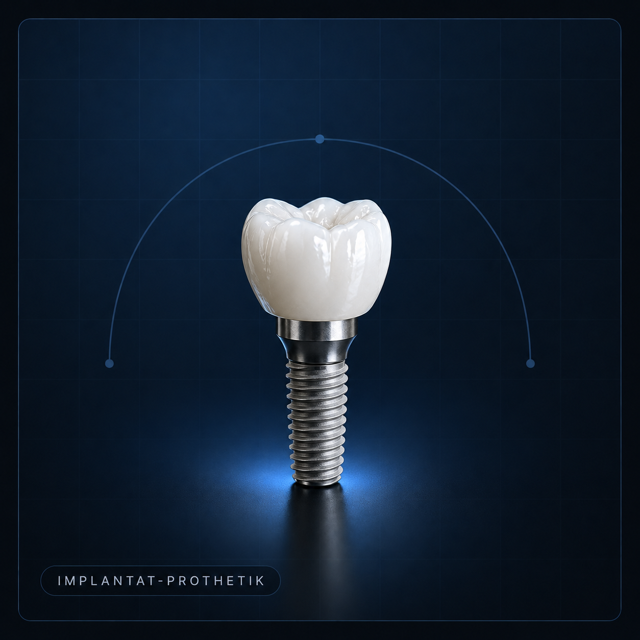 Implantat-Prothetik