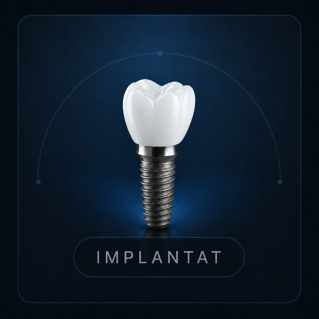 Implantatgetragener Zahnersatz